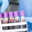 Коронавирусом за сутки заболело 27 владимирцев - ИД Томикс