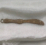 Владимирские врачи извлекли из кишечника 4-летнего ребенка металлический игрушечный кинжал - Zebra-TV.Ru